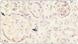 Image of urate in ducts of renal medulla